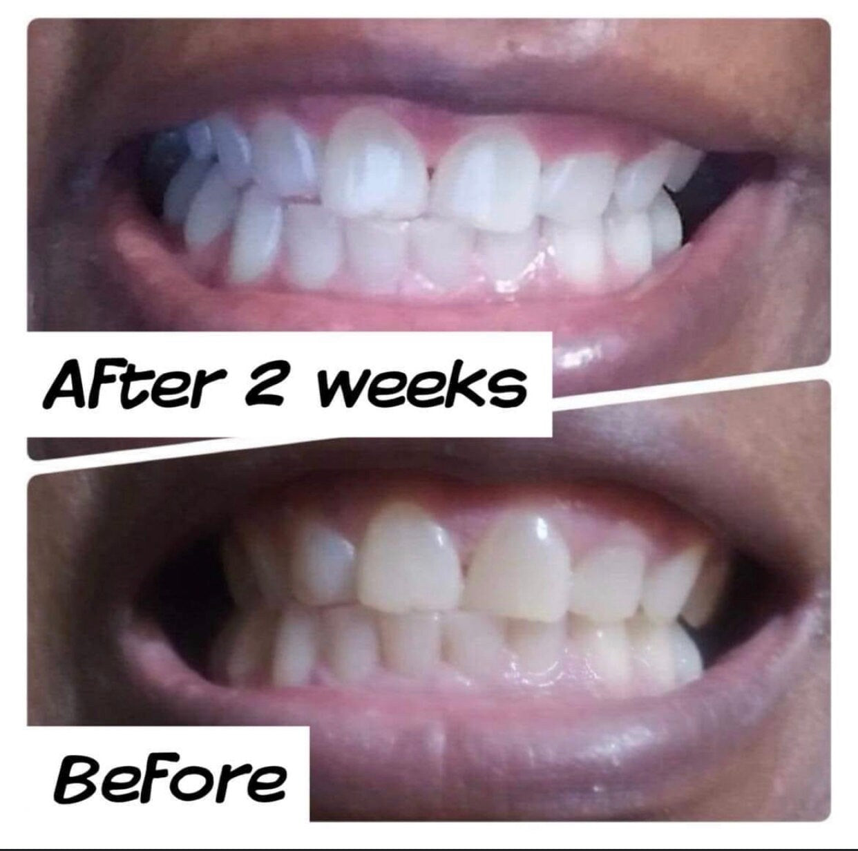 AP24 Whitening Toothpaste