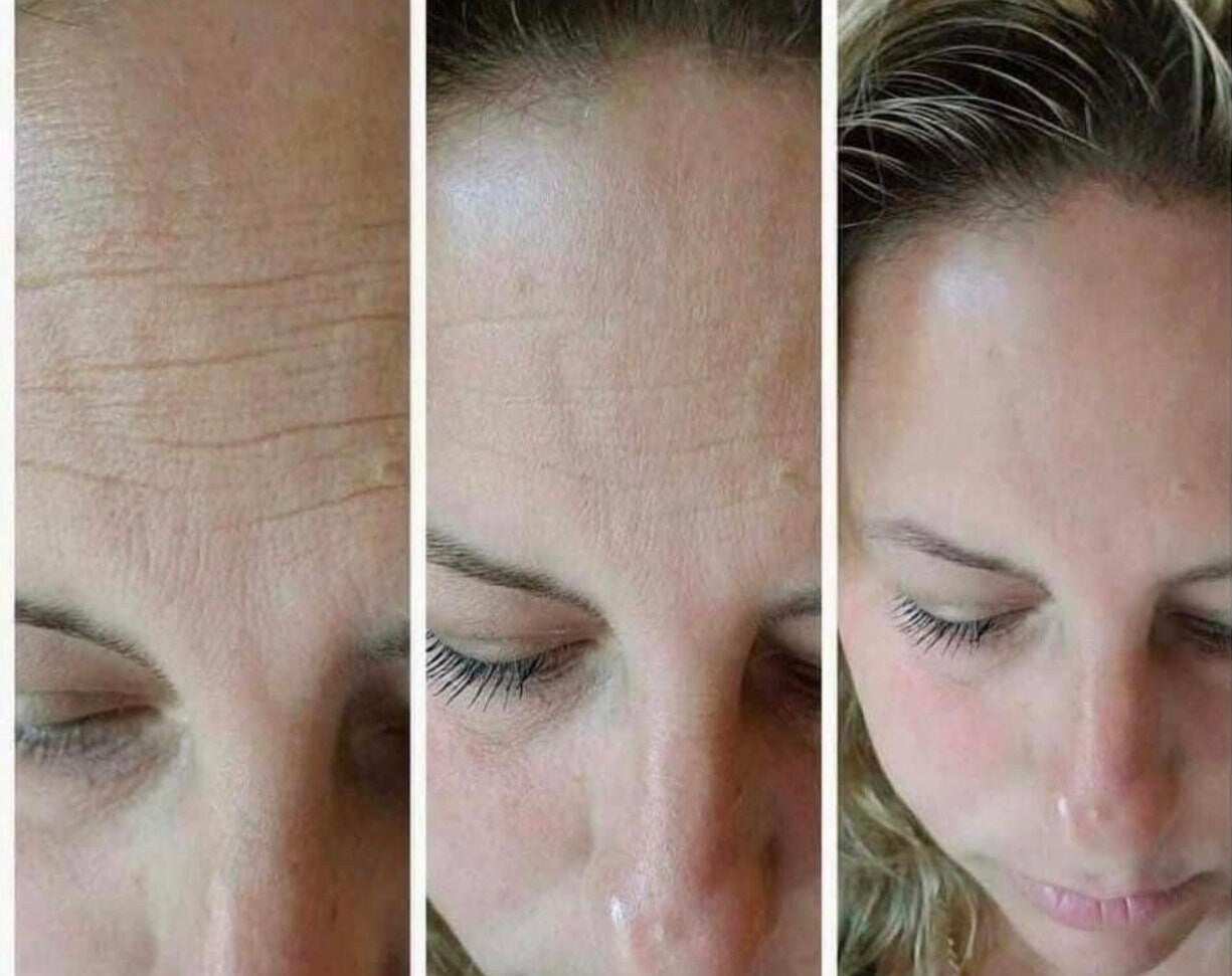 Tru Face Line Corrector Serum