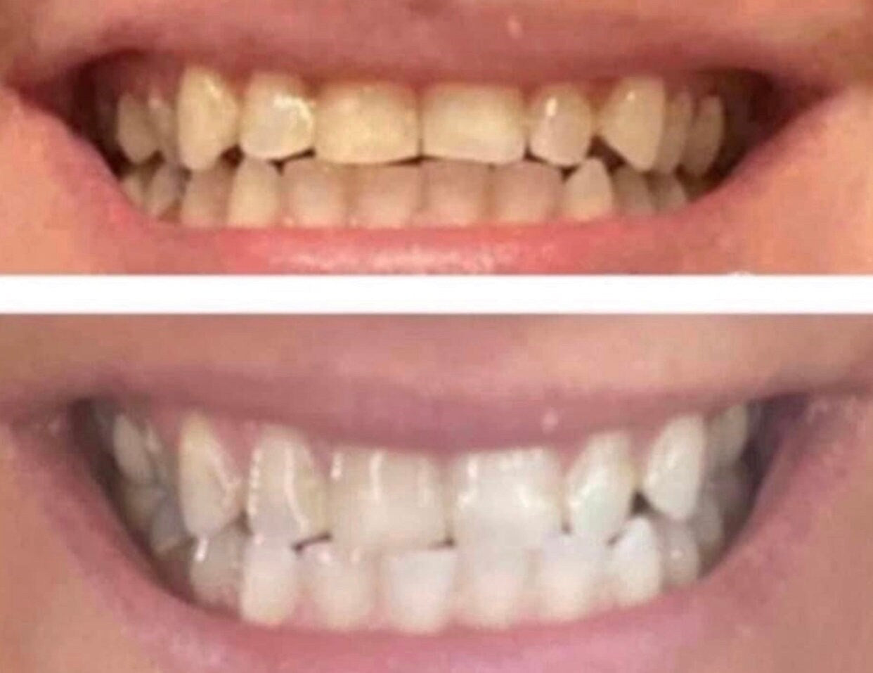 AP24 Whitening Toothpaste