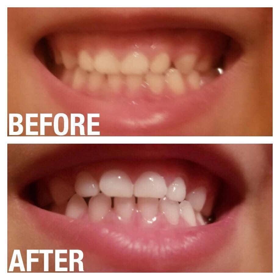 AP24 Whitening Toothpaste